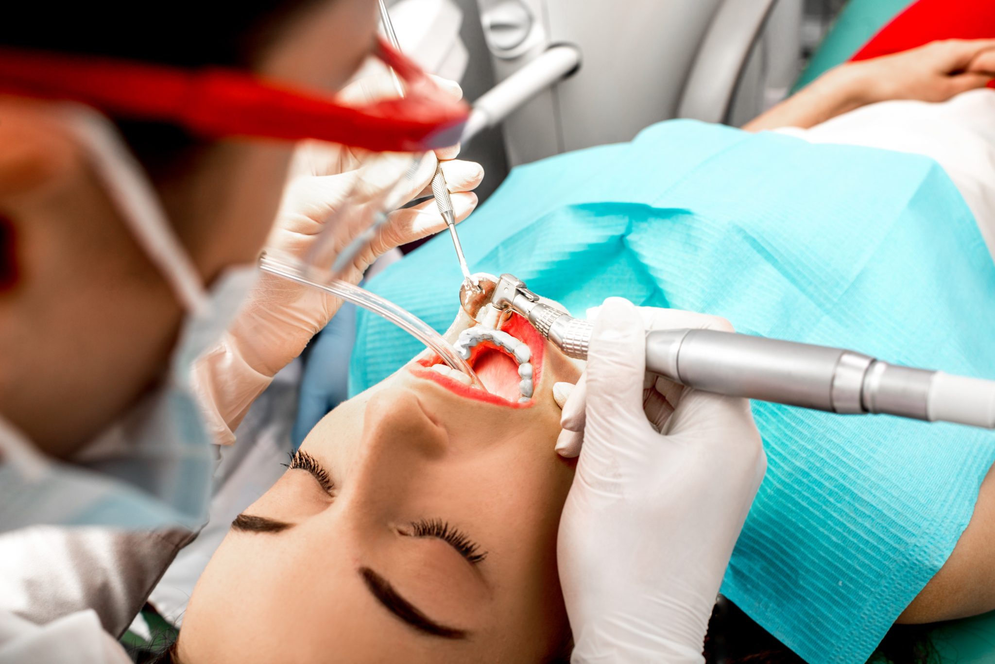 Professional Teeth Cleaning by a Dentist