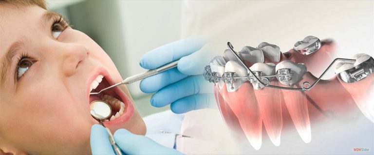 Why an Orthodontist Is the Best Decision